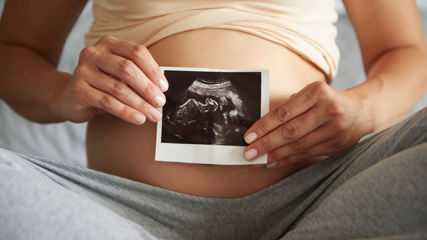 Pro-life, Ultrasound of baby
